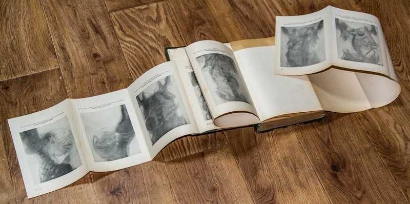 Книга "Акушерство" проф. Эрнст Бумм  1924 г