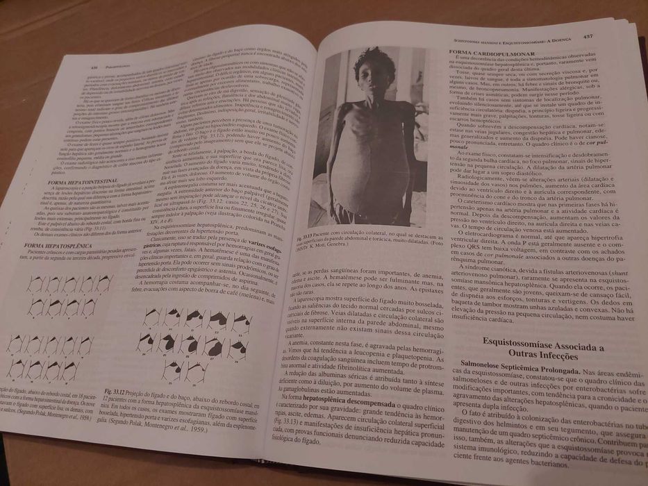 Livro Técnico em Português "Parasitologia", Luis Rey - 3ª Edição