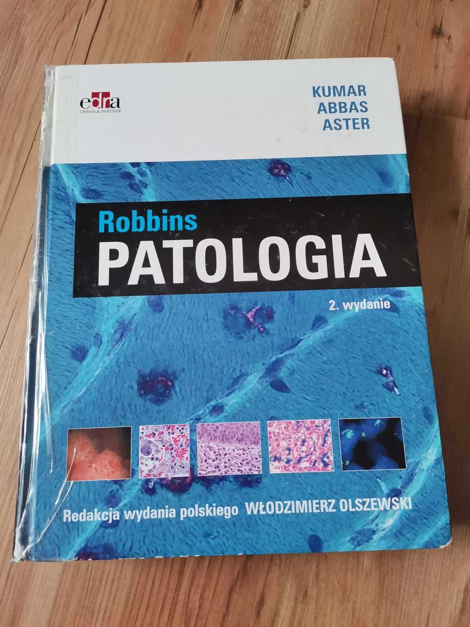Robbins Patologia