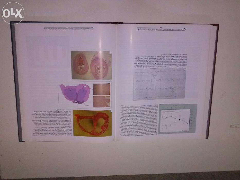 Atlas of Heart Diseases