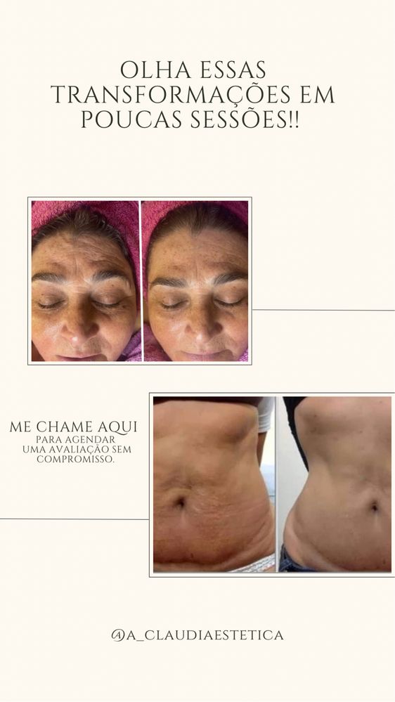 Estética e bem-estar da MULHER!