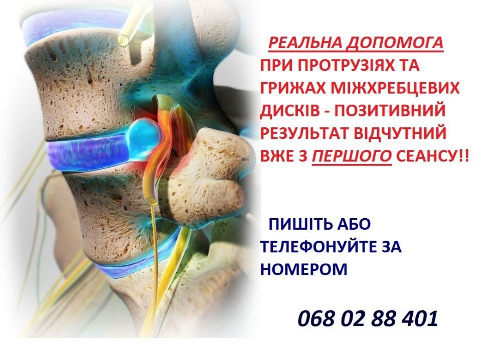 МАСАЖ, корекція хребта (мануальна терапія)