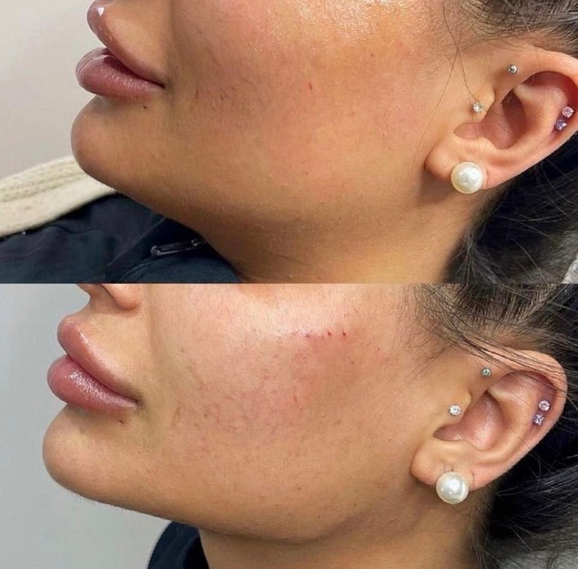 Botox/fullFace/контурная пластика/ губы
