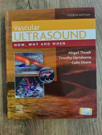 Vascular Ultrasound How, Why and When