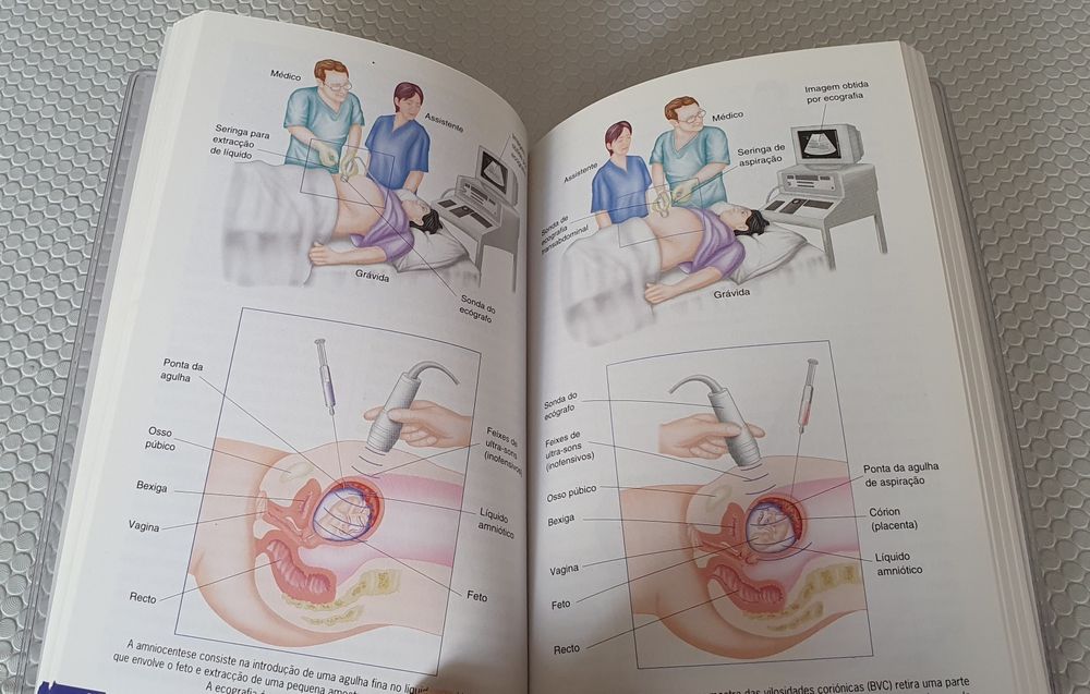 Compreender a gravidez - Livro de bolso