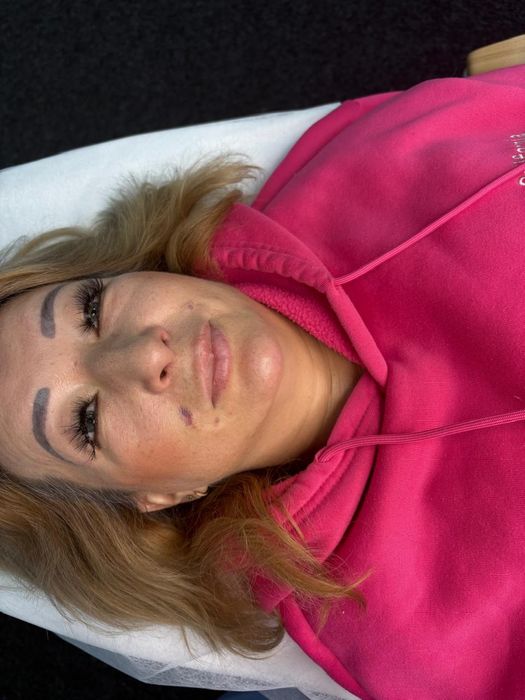 Пошук моделей на губи та ботокс