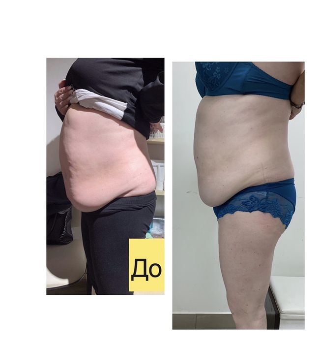 Корекція тіла. Масаж. Обгортування