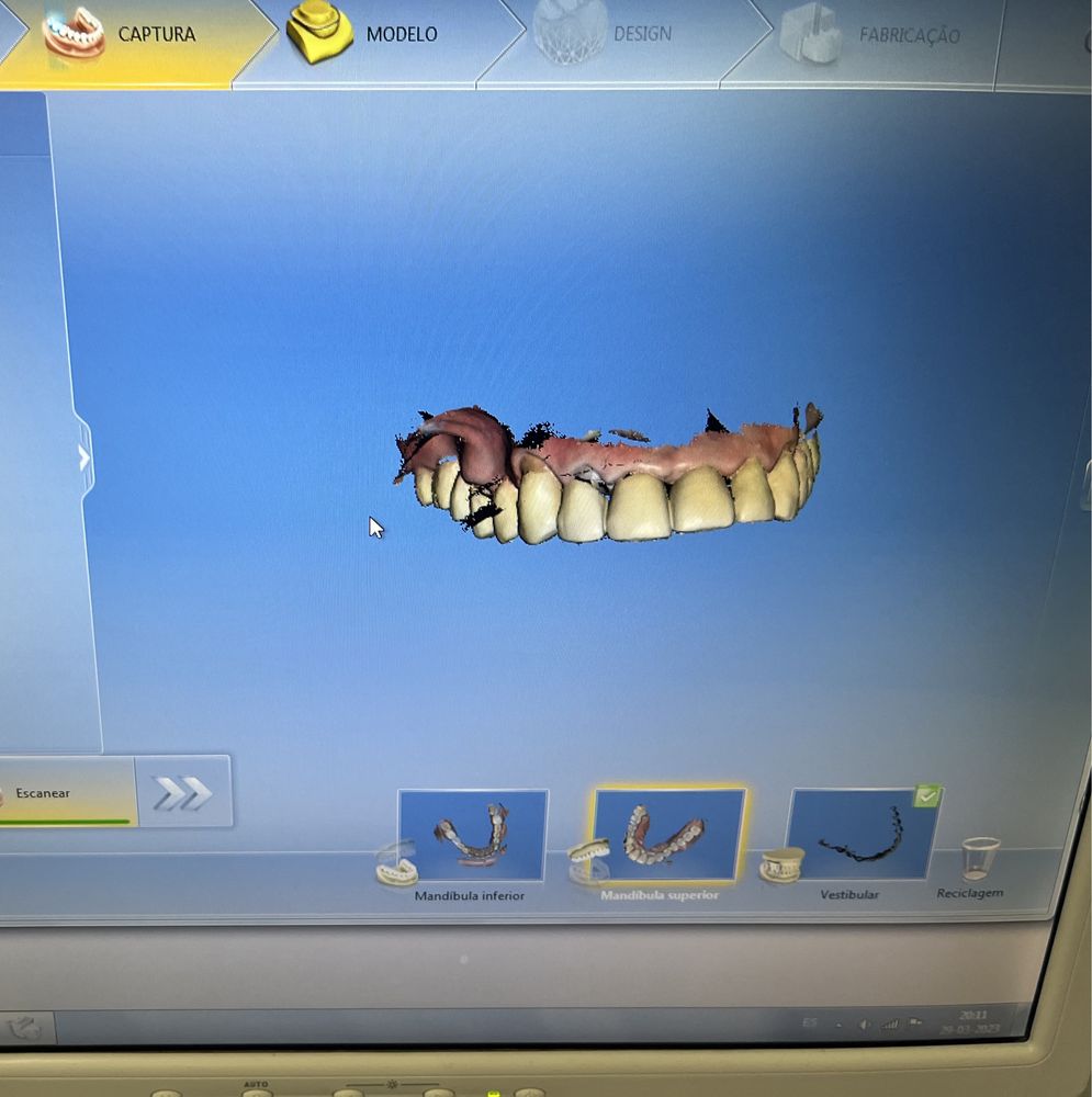 Scanner Intra Oral - Sirona
