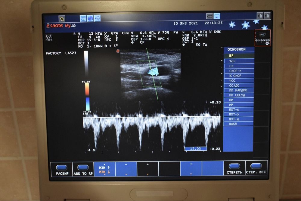 Кардиологический узи узд Ветеринарный сканер ESAOTE MyLab 25 +лицензии