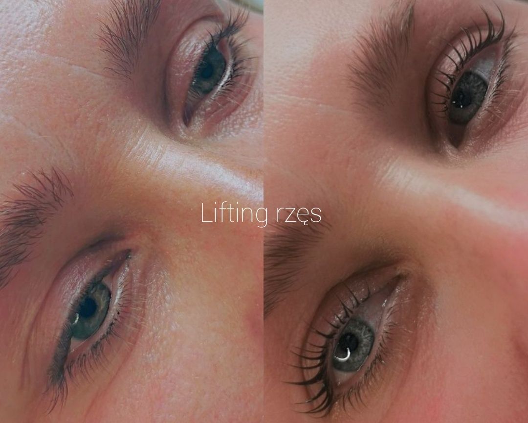 Przedłużanie rzes,,lifting,laminowanie,botox h