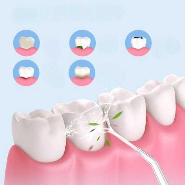 Irygator do zębów bezprzewodowy dentystyczny mocny