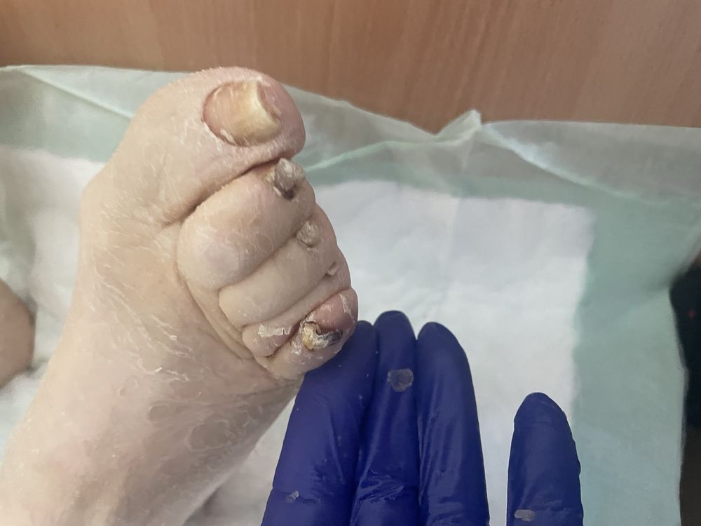 Trudne paznokcie starsze osoby oraz przedluzanie i hybryda