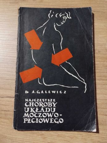 Najczęstsze choroby układu moczowo-płciowego Galewicz