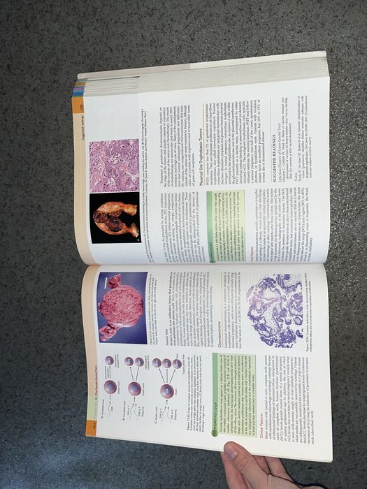 Атлас патології Pathologic basis of disease Robins and Cotran