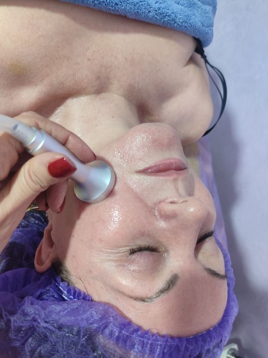 Мікроголковий рф,вакуумно-роліковий масаж в центрі та на Таїрова!