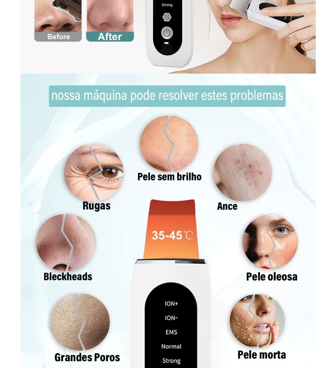 Limpador facial ultrasonico,remove, acne ,poros,esfoliante, rugas.