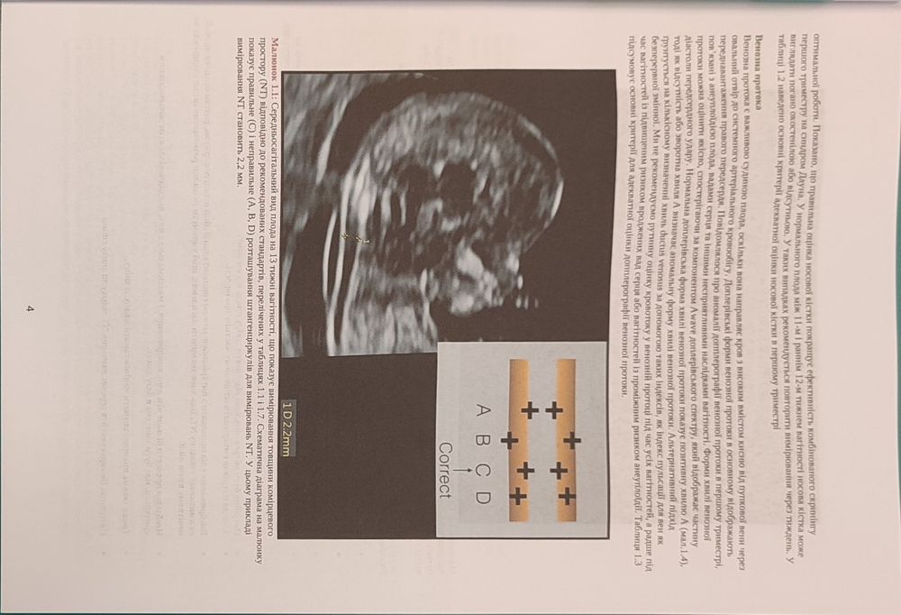 First Trimester Ultrasound Diagnosis of Fetal Abnormalities
