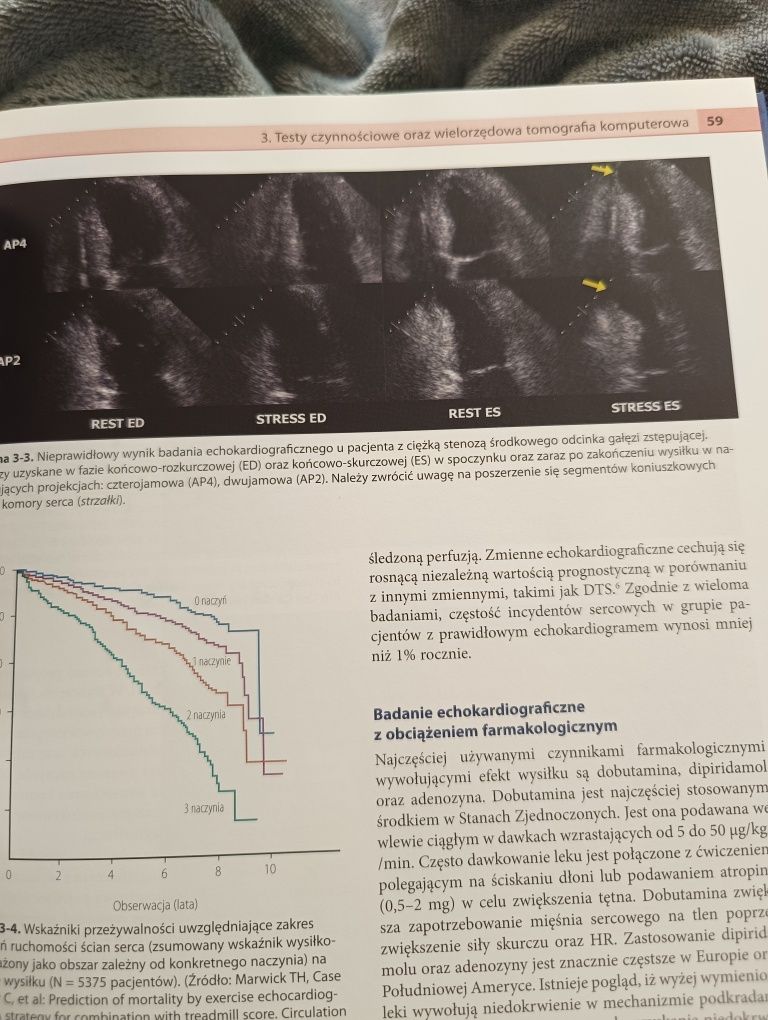 Kardiologia interwencyjna tom 1