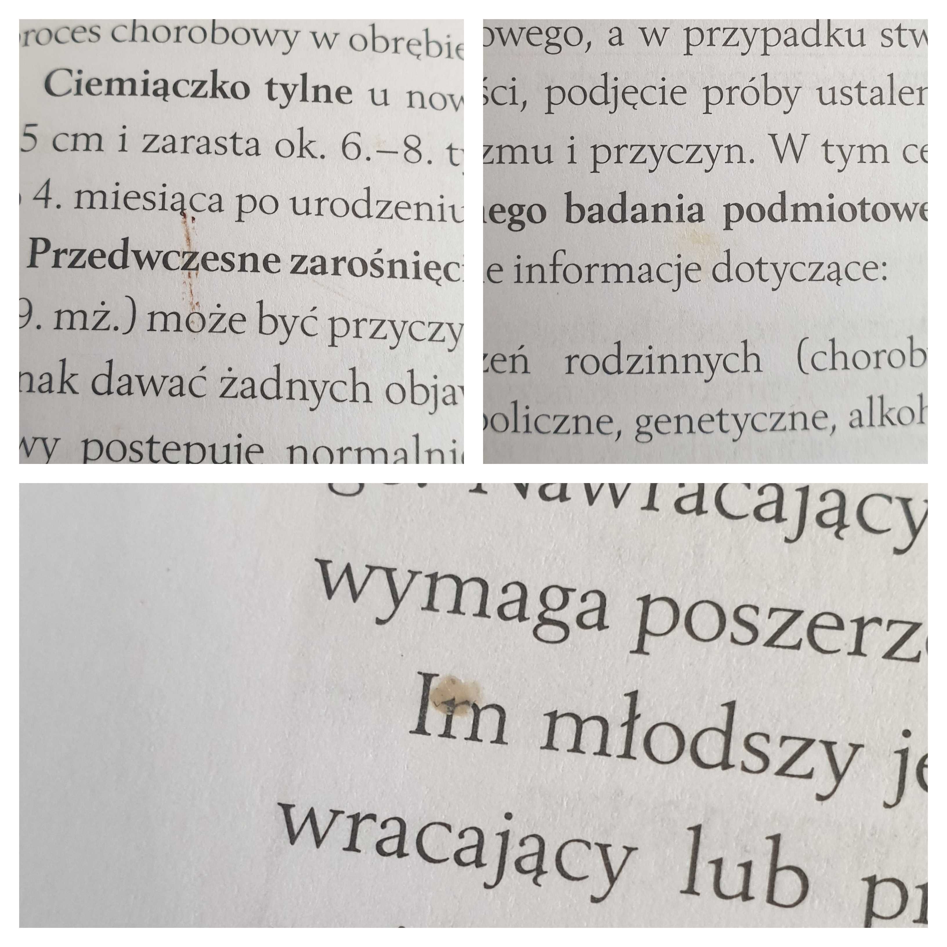 Pediatria Kawalec Grenda Kulus WUM UMB dwa tomy wyd. II 2018