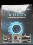 OCT i OCTA w chorobach siatkówki