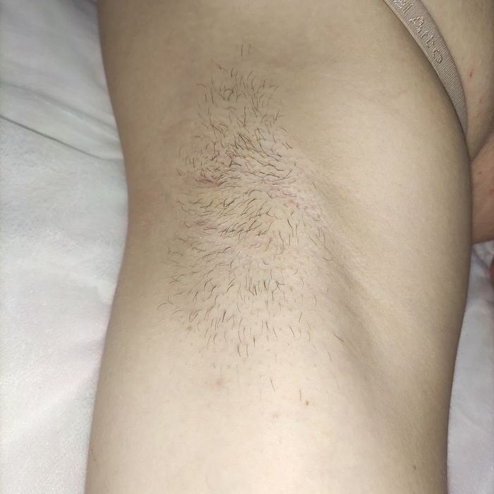 Шугаринг, воскова депіляція. Знижка -10% новому клієнту