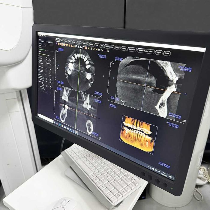 Комп'ютерний Томограф Gendex GXDP-700 2D/3D