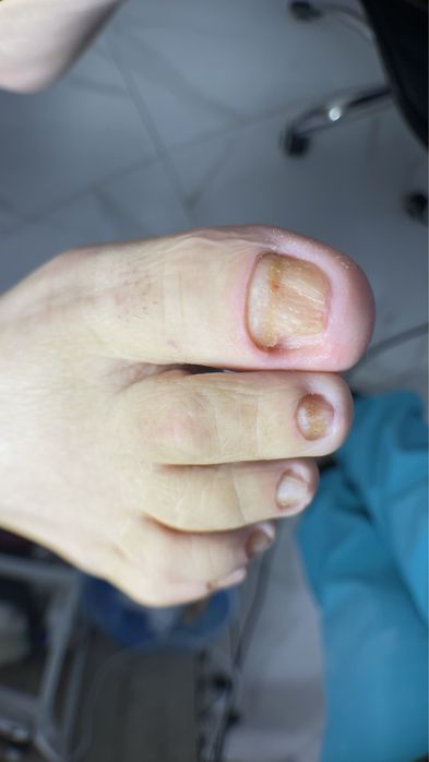 Подолог Мукачево,педикюр Мукачево