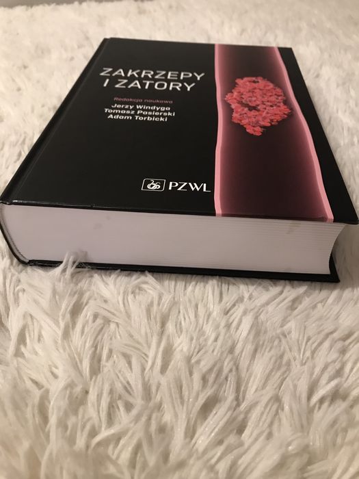 Zakrzepy i zatory Windyga Pasierski Torbicki