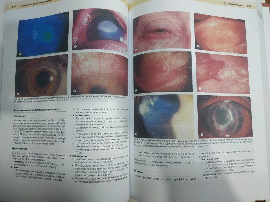 Клиническая офтальмология - Кански Дж.