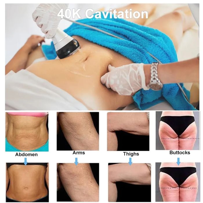 Cavitação Radiofrequência Vácuo Lipolaser