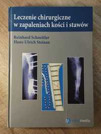 Leczenie chirurgiczne w zapaleniach kości i stawów - wyd. z 2011r.