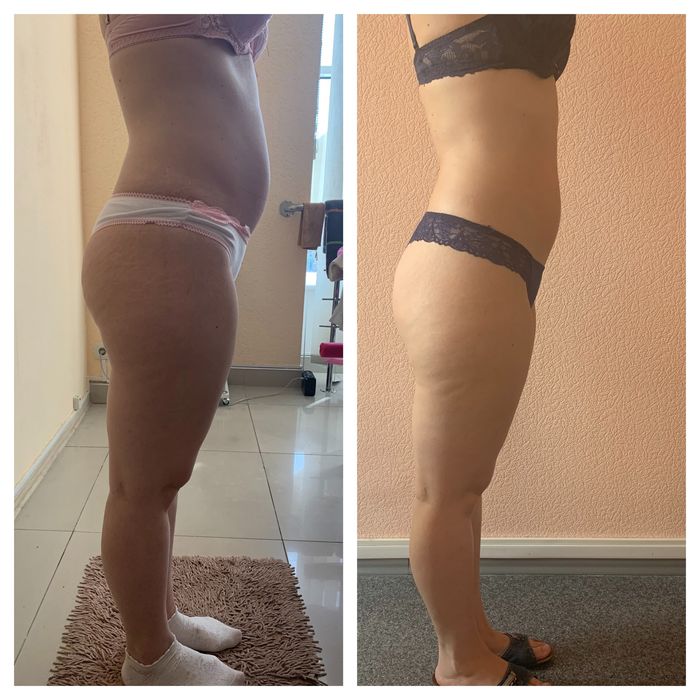 Массаж антицеллюлитный,общий,оздоровительный