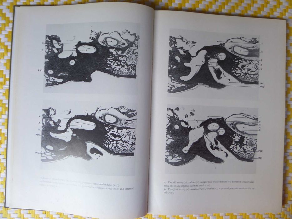 Atlas of the Histopathology of Ear Tumours
P.G. Gerlings