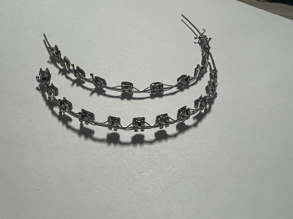 Брекети металеві