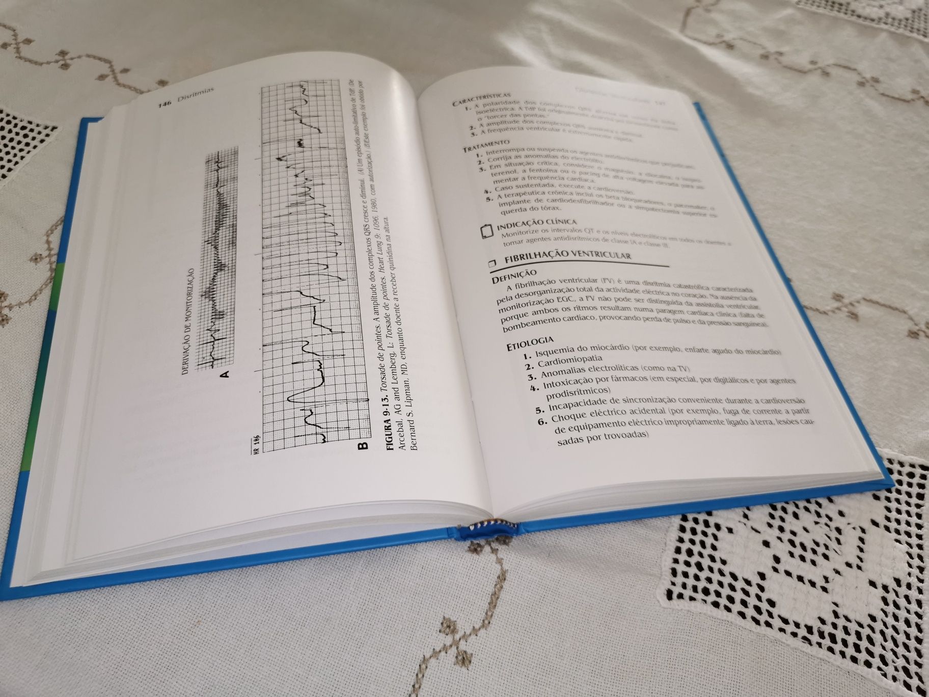 ECG Avaliação e Interpretação