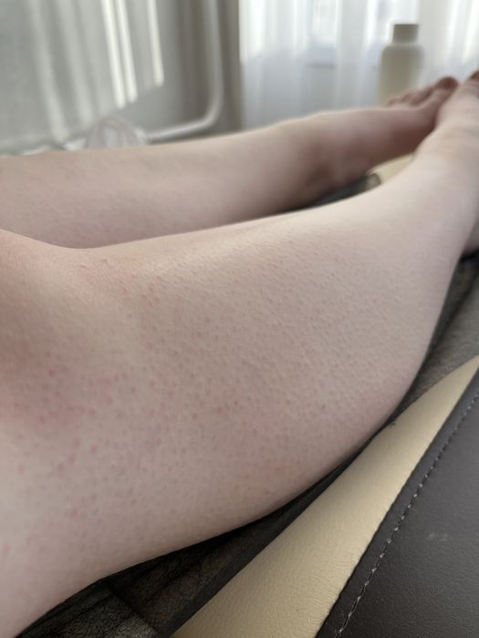 Шугаринг, сахарная депиляция 5 Заречный