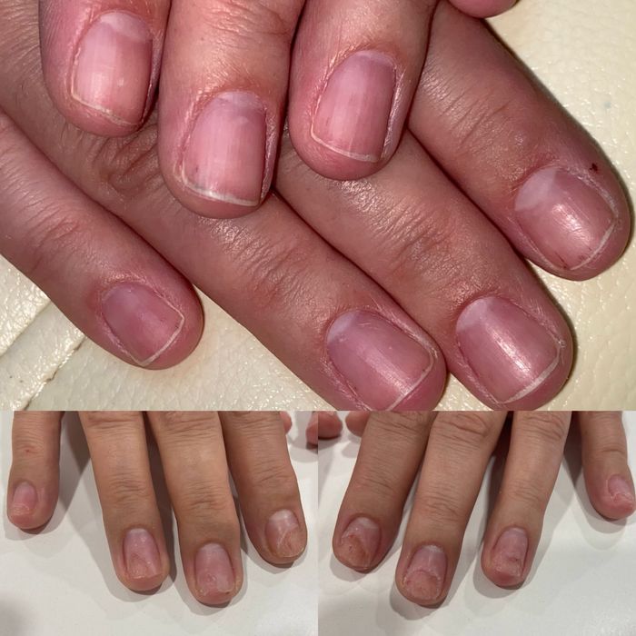 Подолог. Медичний педикюр