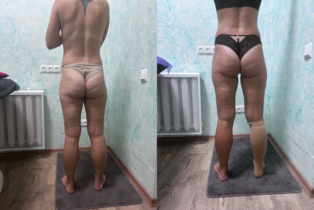 Дівчата запрошую на антецилюлітний масаж п.(Котовського)