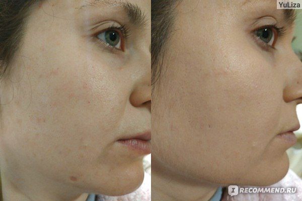 Тональный Vichy Dermablend 3D, флюид лярош,Toleriane Christina