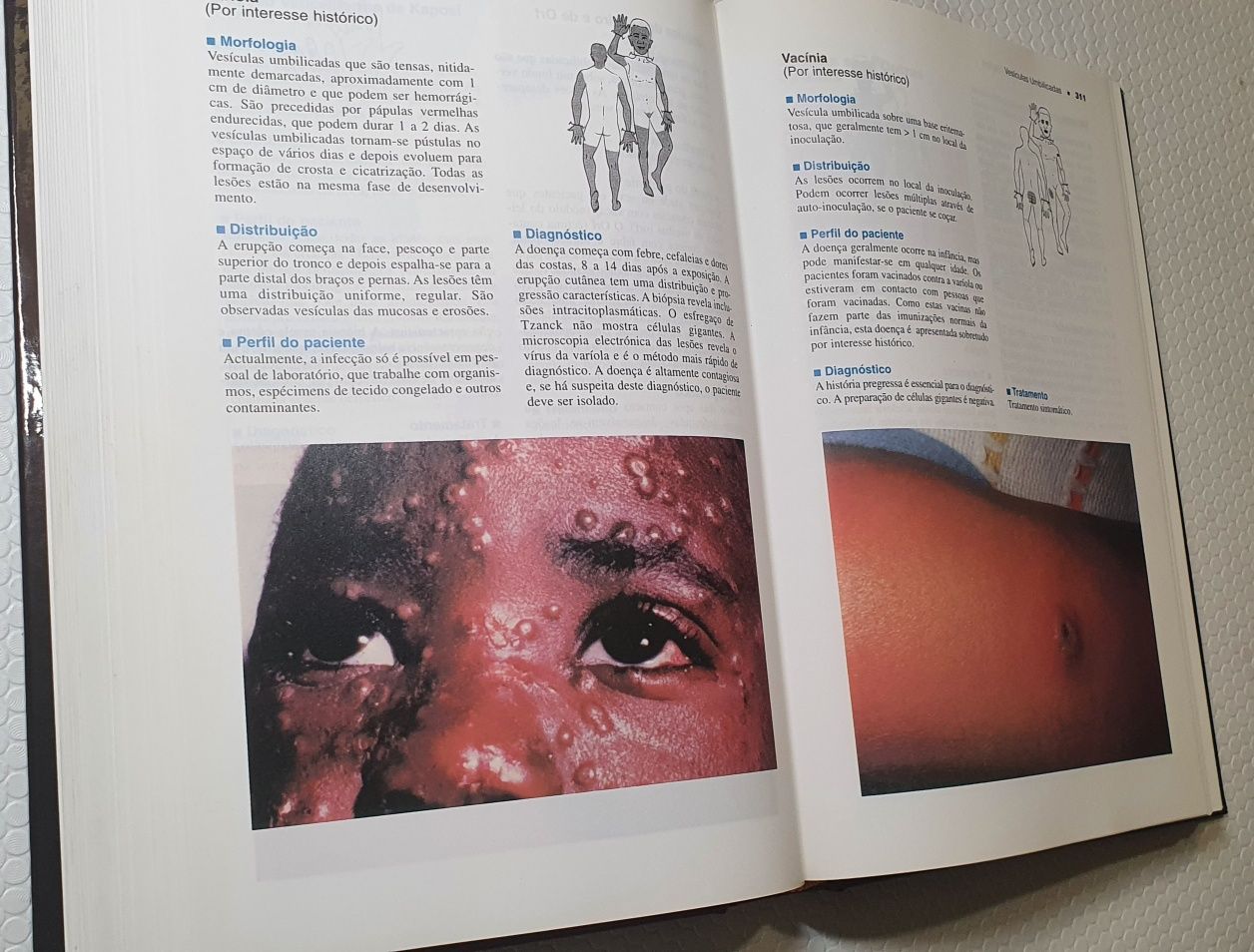Dermatologia de adultos e pediátrica: Guia Ilustrado