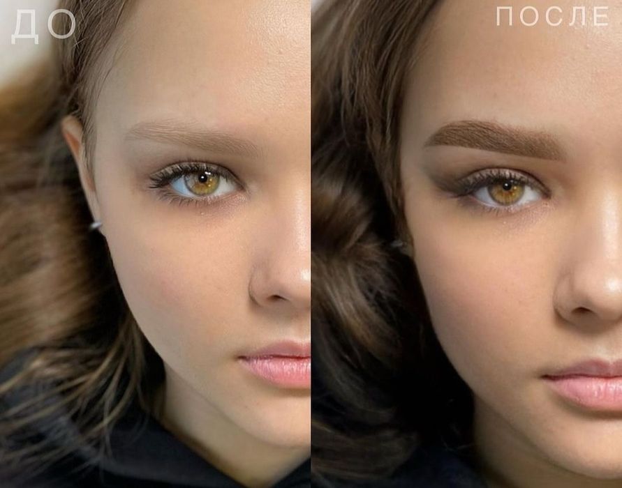 ЛАЗЕРНОЕ  УДАЛЕНИЕ тату и татуажа!