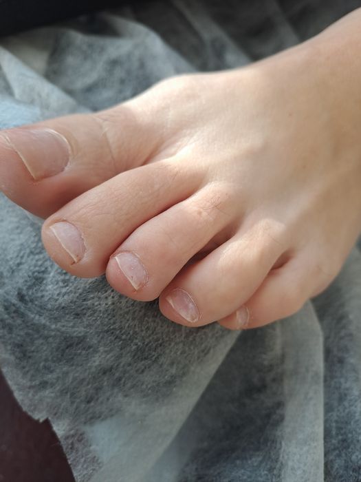 Апаратний педикюр з основами подології в місті СУМИ