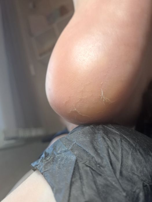 Апаратний педикюр з основами подології в місті СУМИ