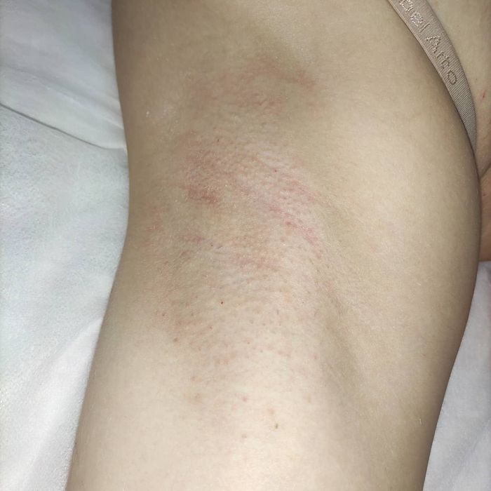 Шугаринг, воскова депіляція. Знижка -10% новому клієнту