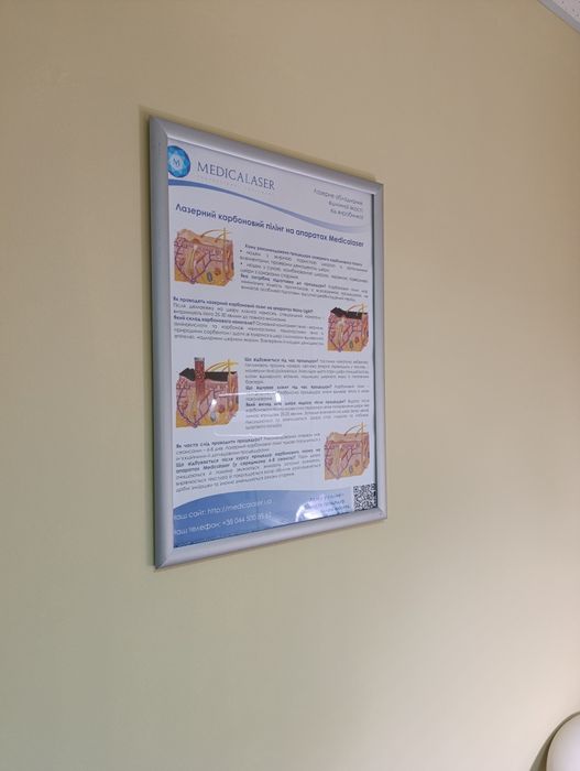 Рамки для плакатів клік система