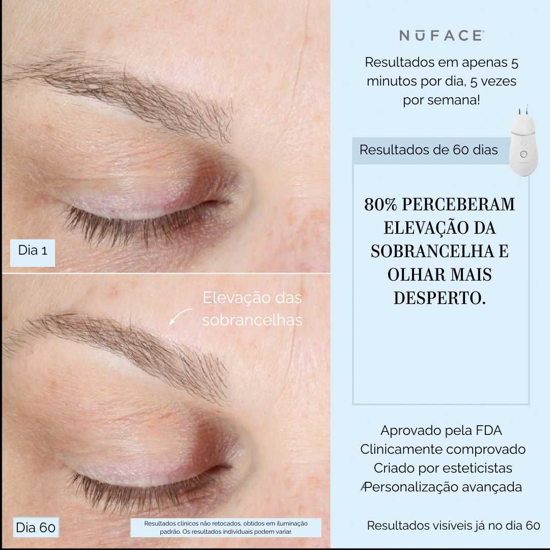 NuFACE Trinity+ com aplicador para lábios e sobrancelhas