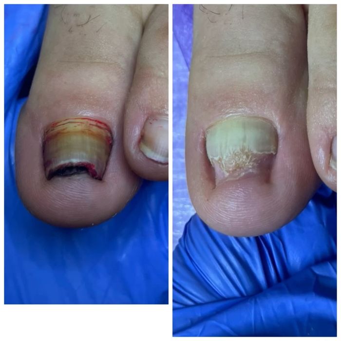 Подолог Харків, Центр. Подологічний педікюр