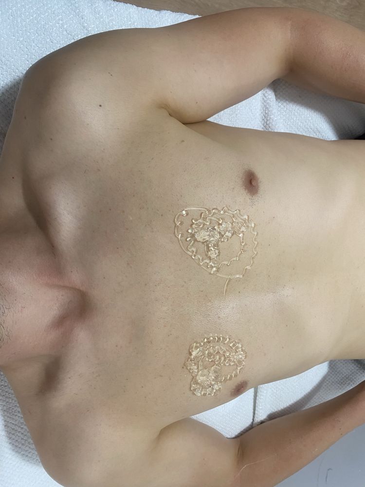 Serviço de depilação a laser