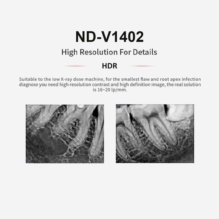 RVG Sensor HDR ND-V1402