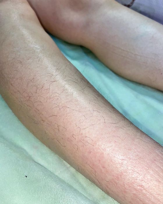 Шугаринг, воскова депіляція. Знижка -10% новому клієнту